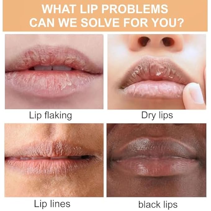 ARCHIDATE 2PCS TURMERIC LIP BALM FOR DARK LIPS, NATURAL TURMERIC MOISTURIZING LIP BALM FOR SMOKERS, LONG-LASTING MOISTURIZE NOURISHES SOFTENS DRY CHAPPED DULL LIPS, REDUCE LIPS LINES - Image 2
